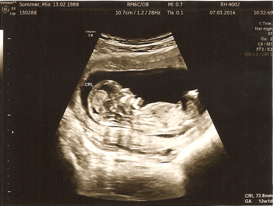 07-03-2014_Nakkefold